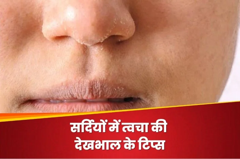 Winter Care Tips: सर्दियों में नहीं सताएगा skin का Dryness , इन 3 तरीकों से इस्तेमाल कर लें glycerin